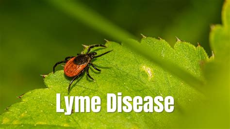Lyme Disease Symptoms Causes Questions Answered Elitecare Emergency
