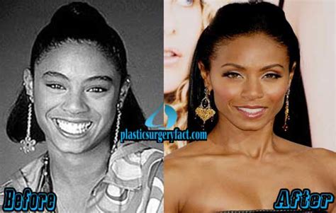 Jada Pinkett Smith Plastic Surgery Before And After Photos