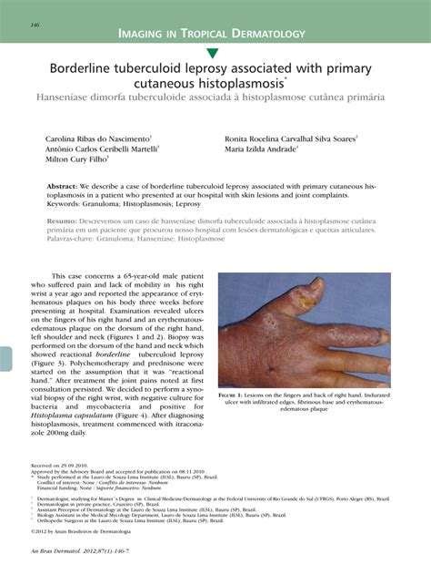 Borderline Tuberculoid Leprosy Leprosy Consists Of Macrophages With