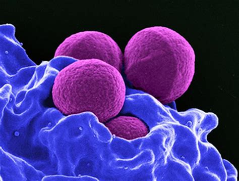 Investigators May Unlock Mystery Of How Staph Cells Dodge Immune System