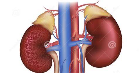 Identification of chronic kidney disease in people with diabetes requires screening for proteinuria, as well as an assessment of serum creatinine converted into an estimated glomerular function rate (egfr). type2 diabetes and health related issues,food,recipes: how ...