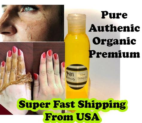 Yellow Peeling Oil Extra Strength Real Medical Grade Etsy
