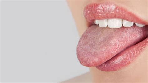 Swollen Taste Buds Causes Getting Rid Of Tip Back Tongue