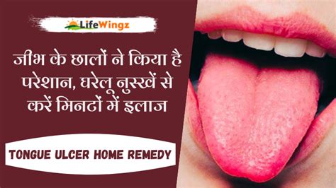 7 Best Home Remedies For Tongue Ulcer जीभ के छालों ने किया है परेशान