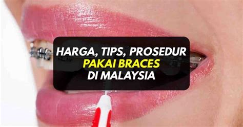 Harga Braces Prosedur Tips Pendakap Gigi Di Malaysia