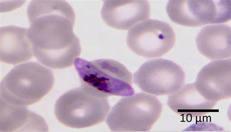 Plasmodium Falciparum Gametocyte Parasitology