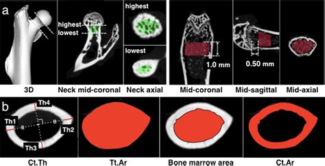 Trabecular And Cortical Bone Parameters By μct The Trabecular Bone