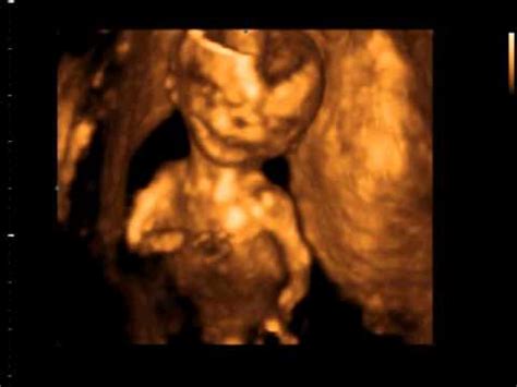 28.03.2011 14 tydzień ciąży - YouTube