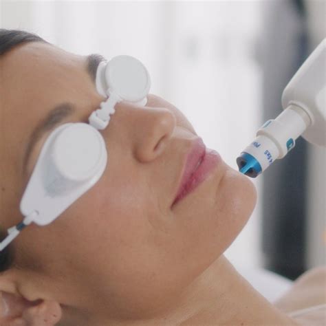 Clearlift Laser Treatments Eyes Face Neck — Align Skincare