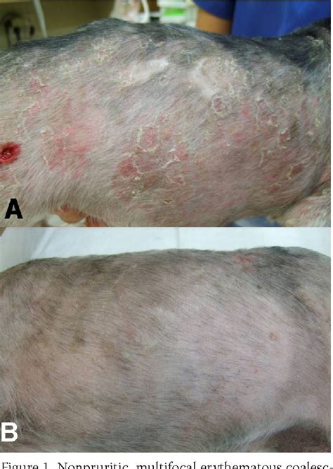 Figure 1 From Erythema Multiforme Minor In A Dog Following