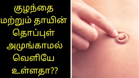 Thoppul Amungamal Veliyae Ulladhabelly Button Came Outside After Delivery தொப்புள் உள்ளே