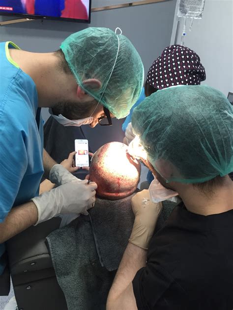 How To Choose The Best Hair Transplant Clinic In Turkey Myhairtr