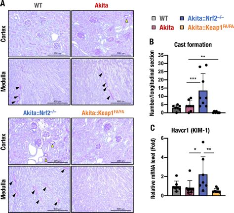 Tubulointerstitial Changes In Akita Mouse Kidneys And Nrf2 A