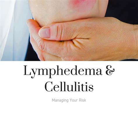 Lymphedema And Cellulitis Managing Your Risk Lymphedema Lymphedema