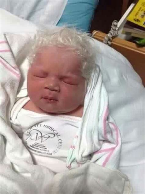 A Black Baby Born With White Hair God Is Amazing Precious Children