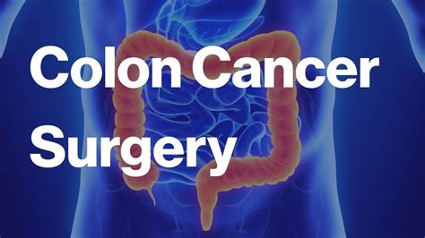 Colon Cancer Surgery YouTube