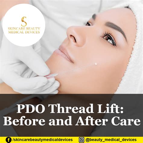 Pdo Thread Lift Before And After Care