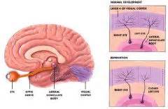 PHYSIOLOGY OF VISION II - 49 Flashcards - Cram.com
