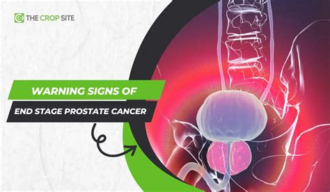 What Are The Signs Of Prostate Cancer Getting Worse