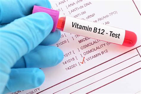 Vitamin B12 Levels Normal Range Chart By Age • Pa Relief