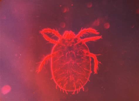 What should you do if you. Recognize and Treat Chigger Bites (With Pictures)