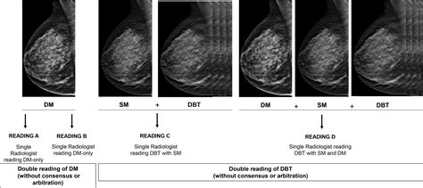 Ai Based Strategies To Reduce Workload In Breast Cancer Screening With