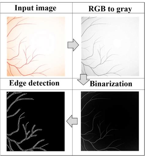 Image Processing Segmentation Procedure For Edge Detection Of Retinal