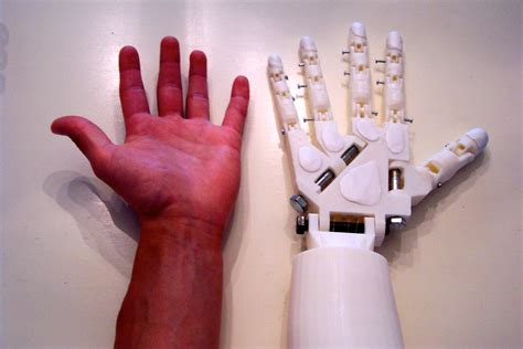 *update* just wanted to add a bit of how posting this instructable has positively impacted me. DIY Prosthetic Hand & Forearm (Voice Controlled) : 14 ...
