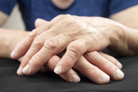 what you need to know about rheumatoid arthritis symptoms and treatment keep asking