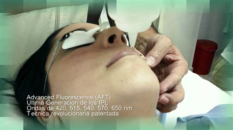 Sep 19, 2021 · existen diferentes métodos para eliminar el vello corporal como rastrillos, cera y cremas, pero aunque son bastante económicas, algunas son dolorosas, oscurecen la piel y finalmente el vello vuelve a crecer a los pocos días. depilacion laser bigote - YouTube