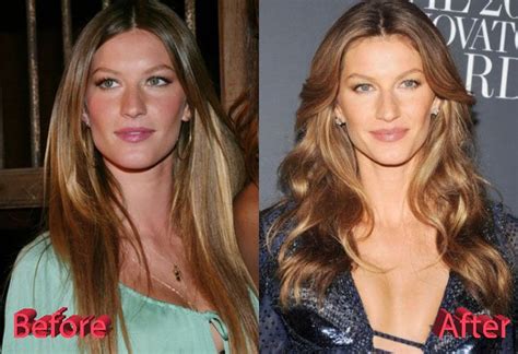 Gisele Bundchen Before And After Plastic Surgery Gisele Hair Gisele