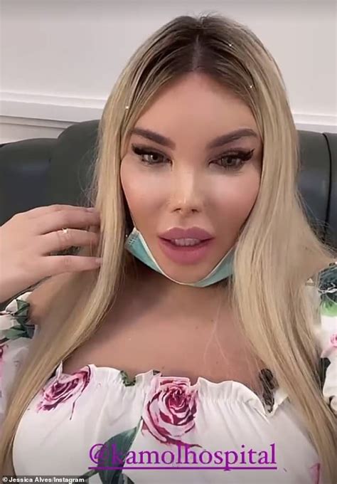 Jessica alves made a name of herself after spending thousands of pounds on plastic surgery to look like a ken doll. Jessica Alves prepares for 'life changing' cosmetic ...