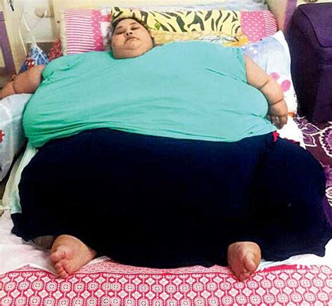 Worlds Heaviest Woman Eman Ahmed Loses Over 100 Kg In 3 Weeks Through Diet And Physiotherapy