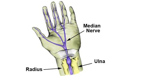 This 26 Hidden Facts Of Median Nerve Entrapment Elbow The Three