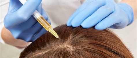 For example, a study in the journal of photochemistry and photobiology b: Platelet-Rich Plasma (PRP) Hair Restoration ...