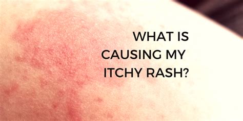 Body Itching At Night Itching Without A Rash 8 Possible Causes And