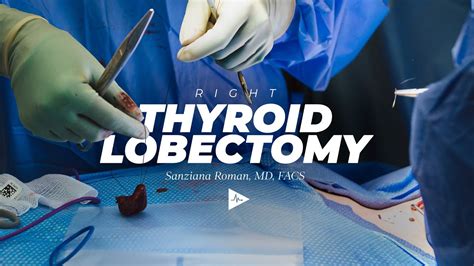 Right Thyroid Lobectomy By Sanziana A Roman Md Facs Youtube