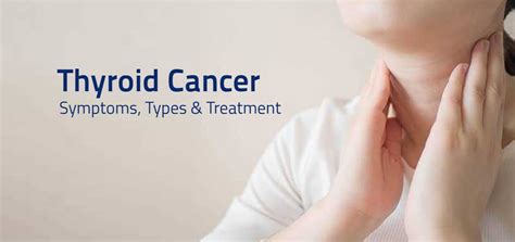 Thyroid Cancer Symptoms Types And Treatment Aster Blog
