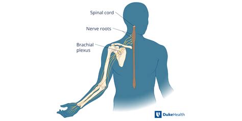 Brachial Plexus Injury Duke Health