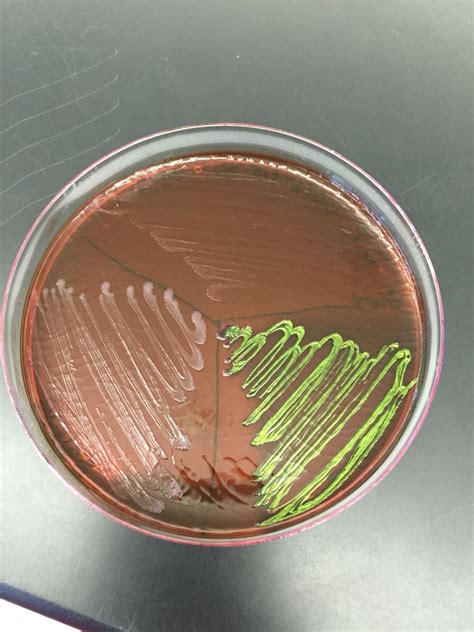 Emb Agar Plate Microbiology Bacteria Agar