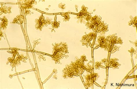 40355 (for references in articles please use ncbi:txid40355). Fonsecaea pedrosoi microscopy-1