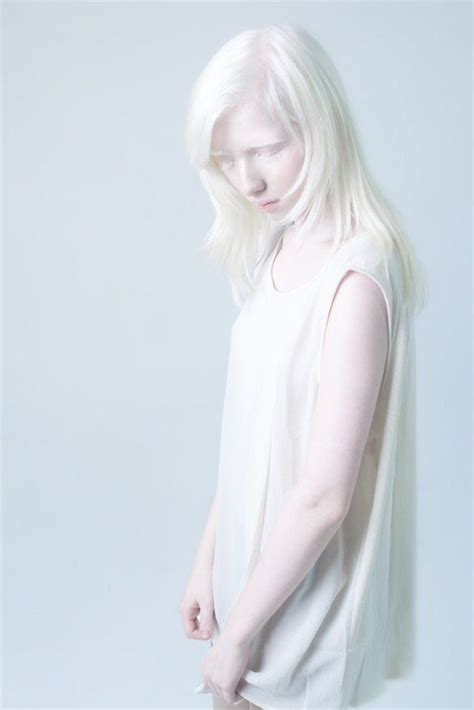 Albino By Via Behance Albino Girl Albino Model Albinism