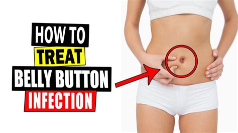 How To Treat Belly Button Infection At Home Home Remedies For Belly Button Infection