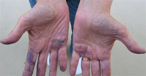 Crackpot Beader: I Have Purple Hands