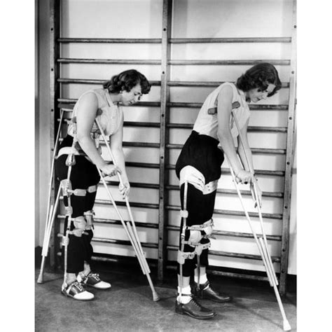 Two Adult Women Polio Victims With Leg Braces Adjust Their Crutches