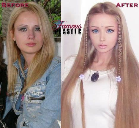 Human Barbie Before And After Google Search Plastic Surgery