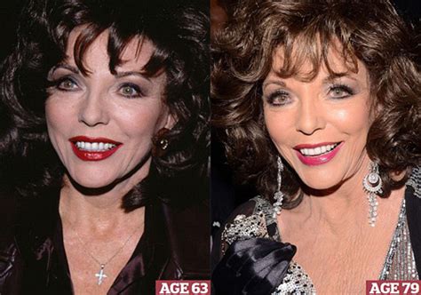 Joan Collins Plastic Surgery Before After Breast Implants