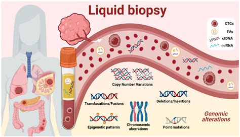 Biomedicines Free Full Text Clinical Utility Of Liquid Biopsy Based Actionable Mutations