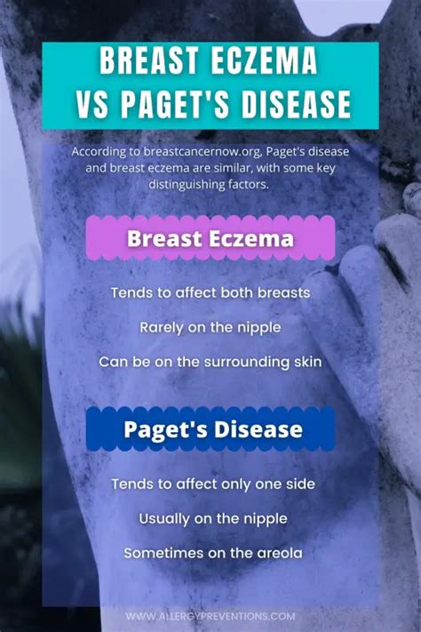 Breast Eczema Vs Pagets Disease Infographic 5 26 Allergy Preventions