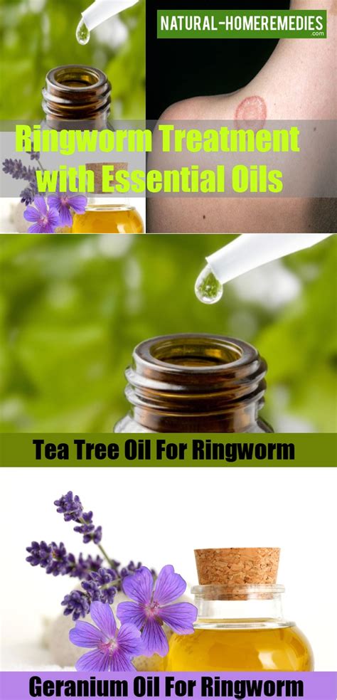 How To Treat Ringworm Essential Oils For Ringworm Treatment For